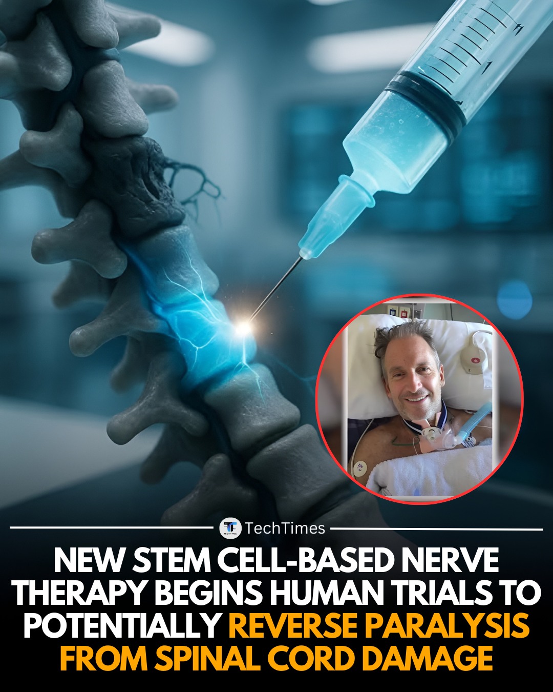 Stem Cell Therapy for Damaged Nerves – experimental regenerative medicine under clinical trial